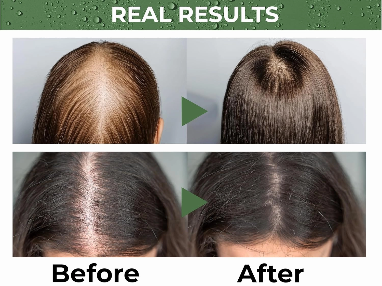 ABERA Advanced Hair Growth Serum – Reduces Hair Shedding & Stimulates Regrowth, Hydrating Scalp Treatment with Grapefruit, 1.69 Fl Oz (2 Boxes Serum   Gift)