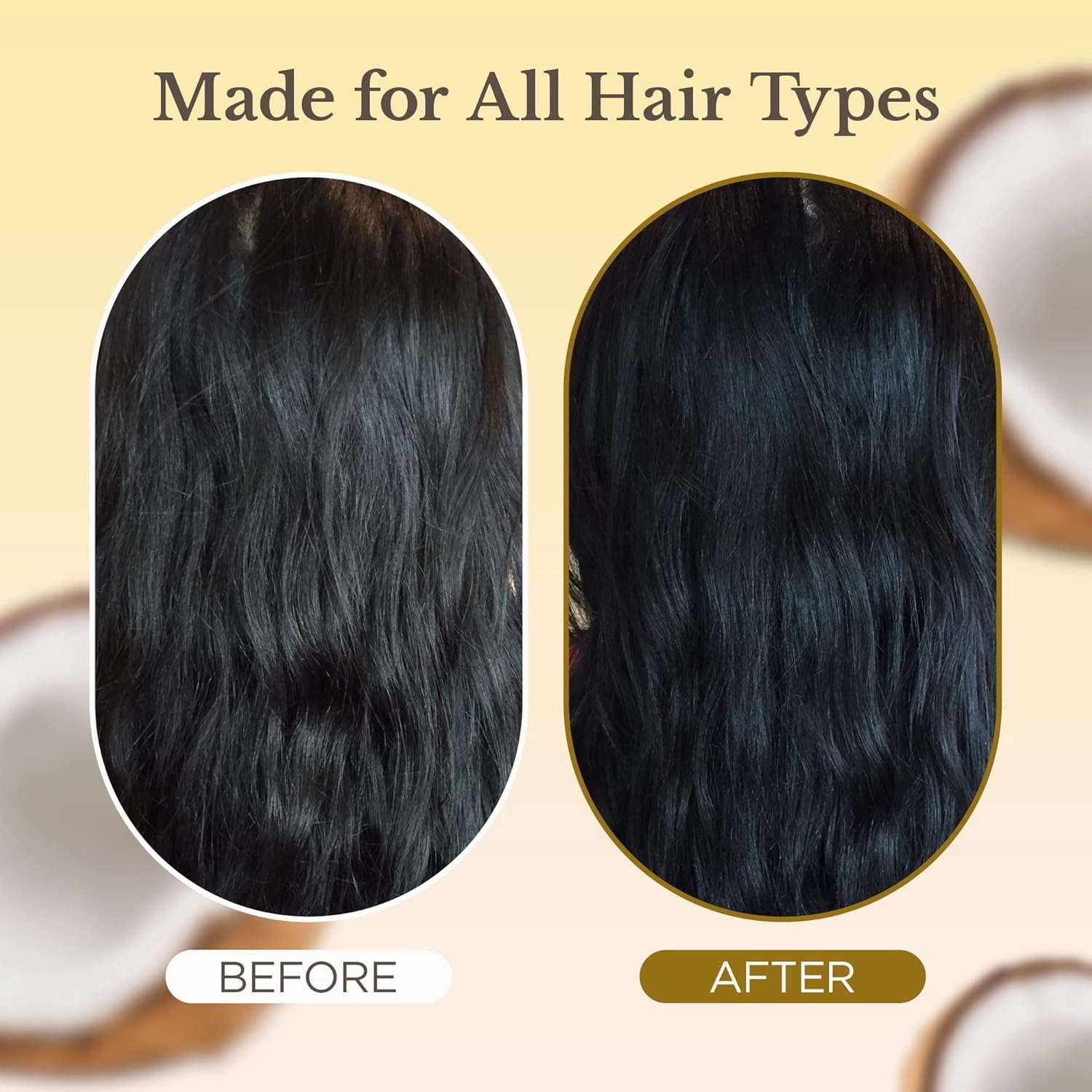 Anti Dandruff,Vegan, and Natural Hydrating Shampoo for Dry, Itchy Scalp, and Damaged Hair with Coconut Oil & Vitamin E, 250ml