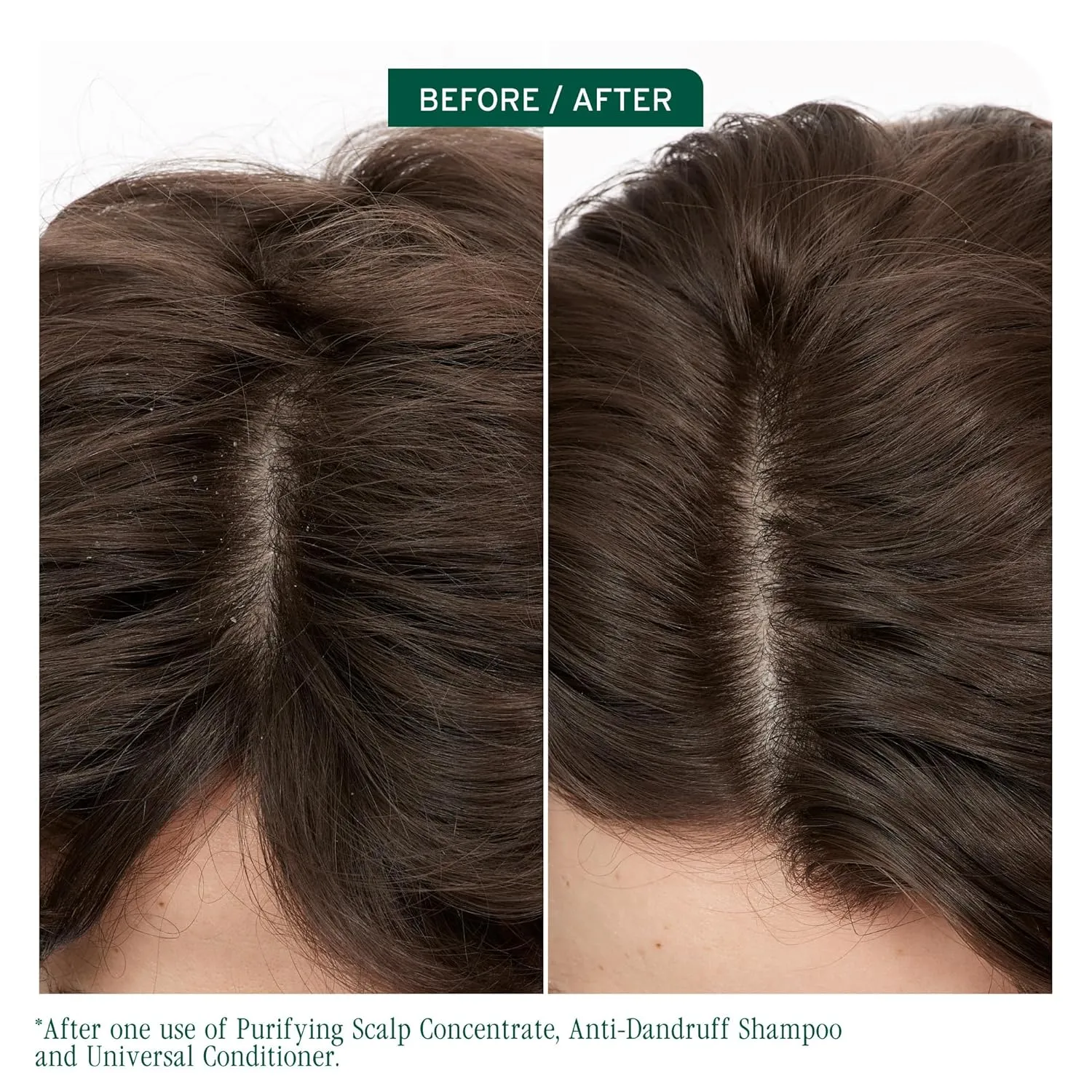Biolage Scalp Sync Anti-Dandruff Shampoo - Controls Dandruff & Deeply Cleanses, With Zinc Pyrithione, Vegan & Cruelty-Free, Packaging may vary