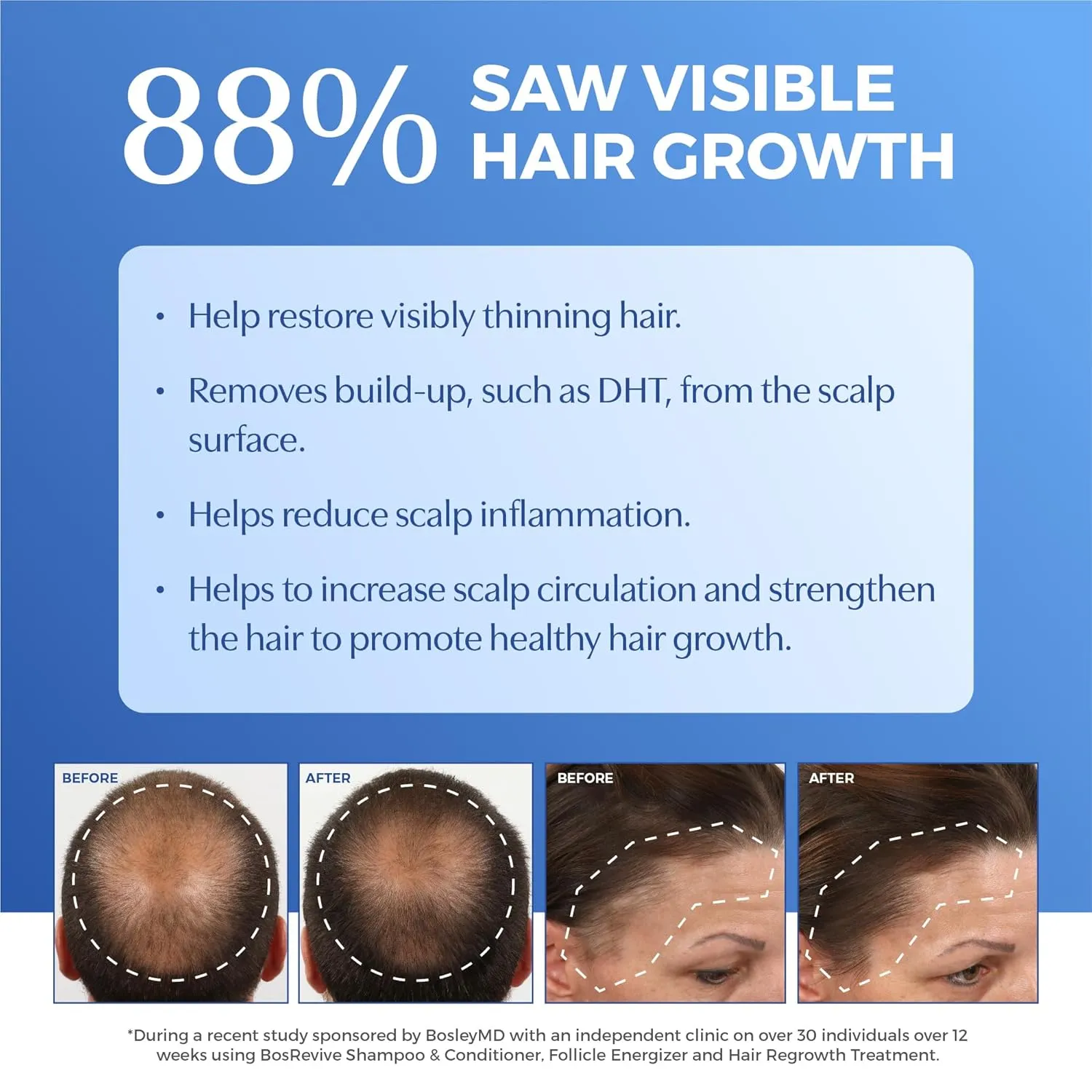 BosRevive Nourishing Shampoo & Conditioner & Kit for Noticeably Thinning and Non Color-Treated Hair Rosemary