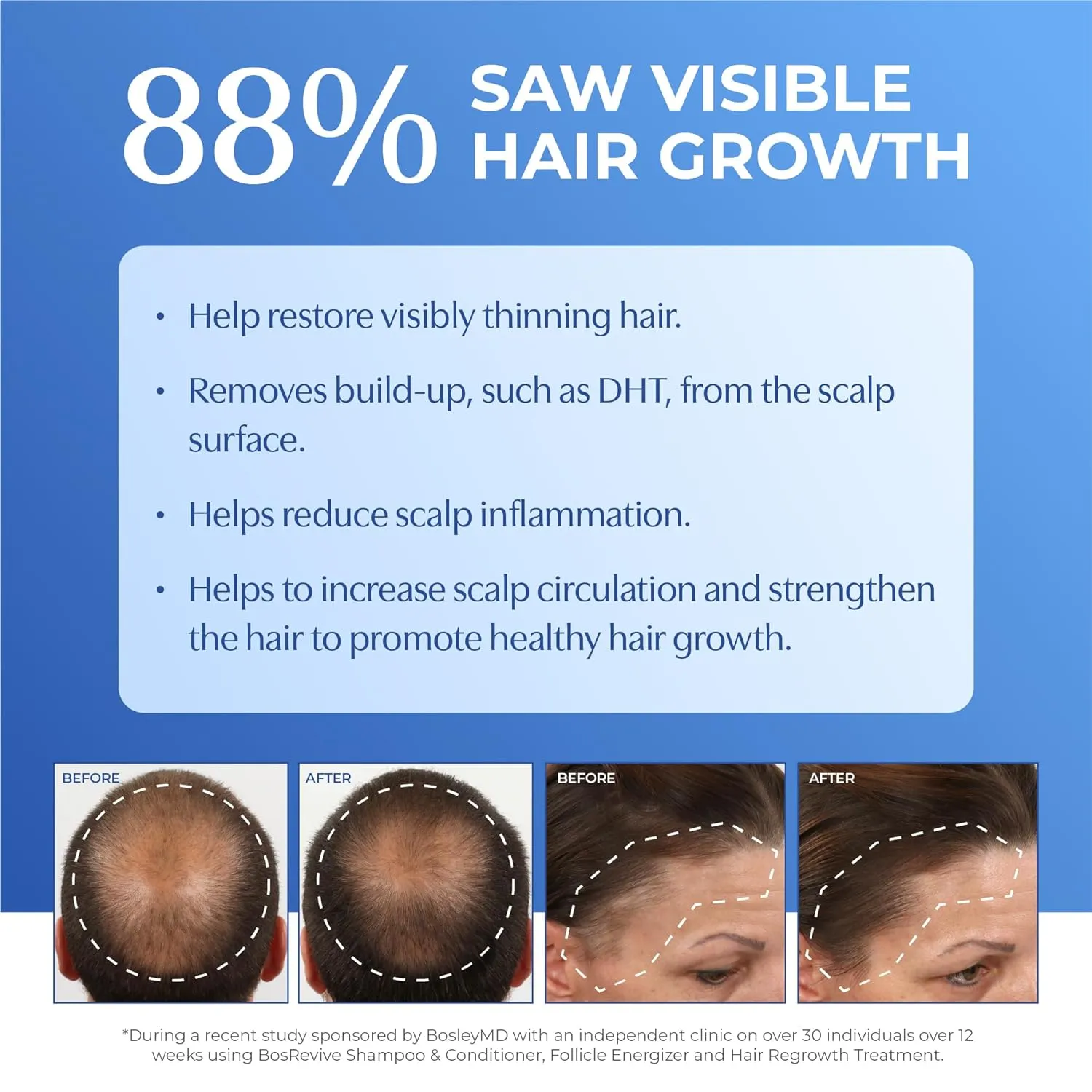 BosRevive Nourishing Shampoo & Conditioner & Kit for Noticeably Thinning and Non Color-Treated Hair Rosemary