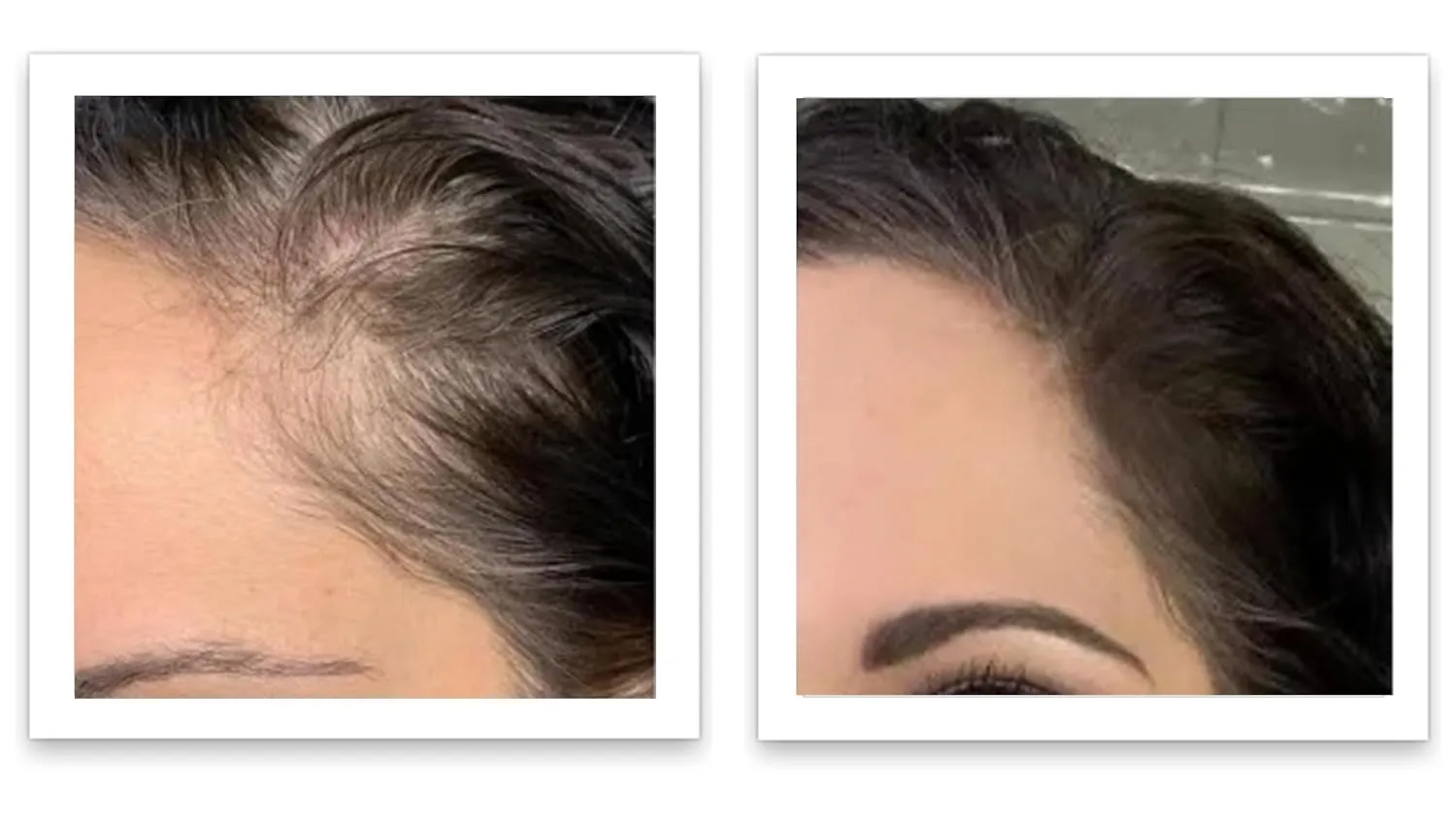 Caboki 10X Volumizing Hair Powder for Thinning Hair: Root Touch Up, Fill in Hairline & Edges, Cover Bald Spots and Gray For Men and Women. TALC-Free,Dark Brown