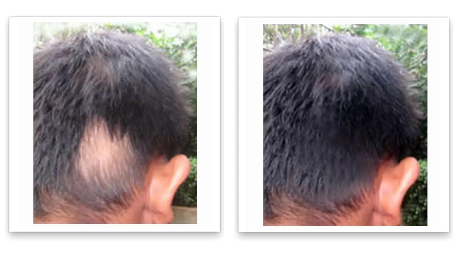 Caboki 10X Volumizing Hair Powder for Thinning Hair: Root Touch Up, Fill in Hairline & Edges, Cover Bald Spots and Gray For Men and Women. TALC-Free,Dark Brown