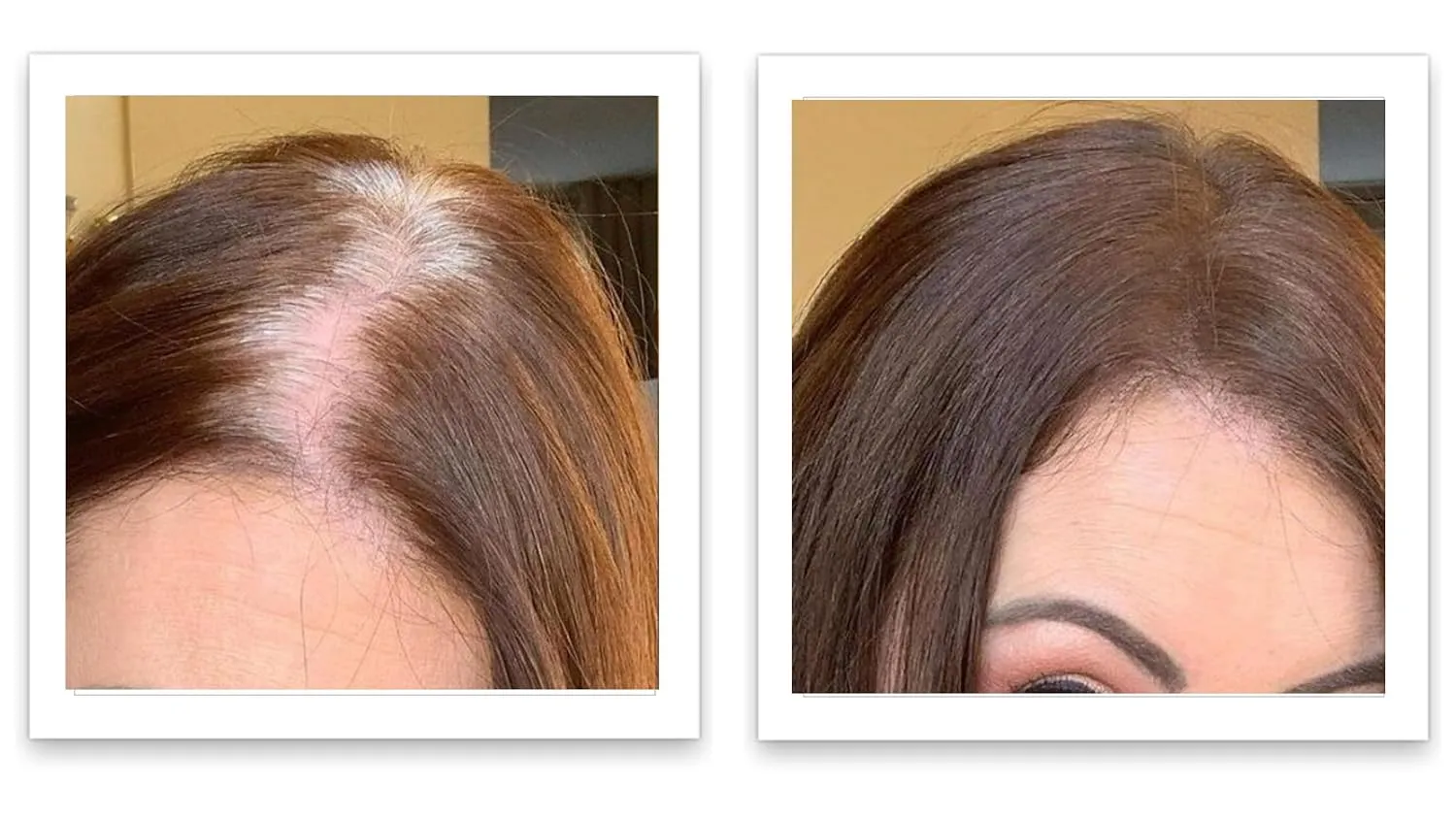 Caboki 10X Volumizing Hair Powder for Thinning Hair: Root Touch Up, Fill in Hairline & Edges, Cover Bald Spots and Gray For Men and Women. TALC-Free,Dark Brown