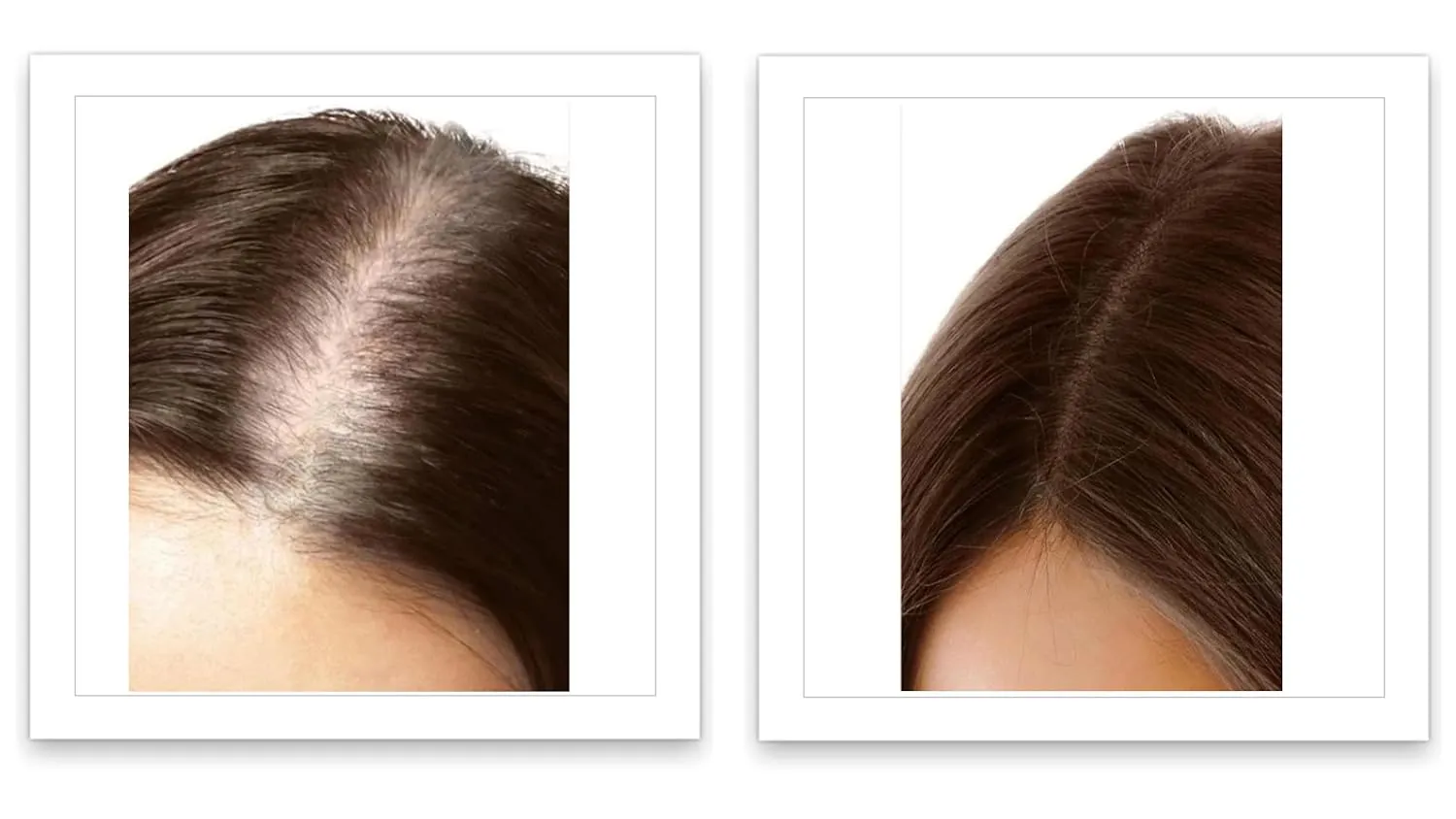 Caboki 10X Volumizing Hair Powder for Thinning Hair: Root Touch Up, Fill in Hairline & Edges, Cover Bald Spots and Gray For Men and Women. TALC-Free,Dark Brown