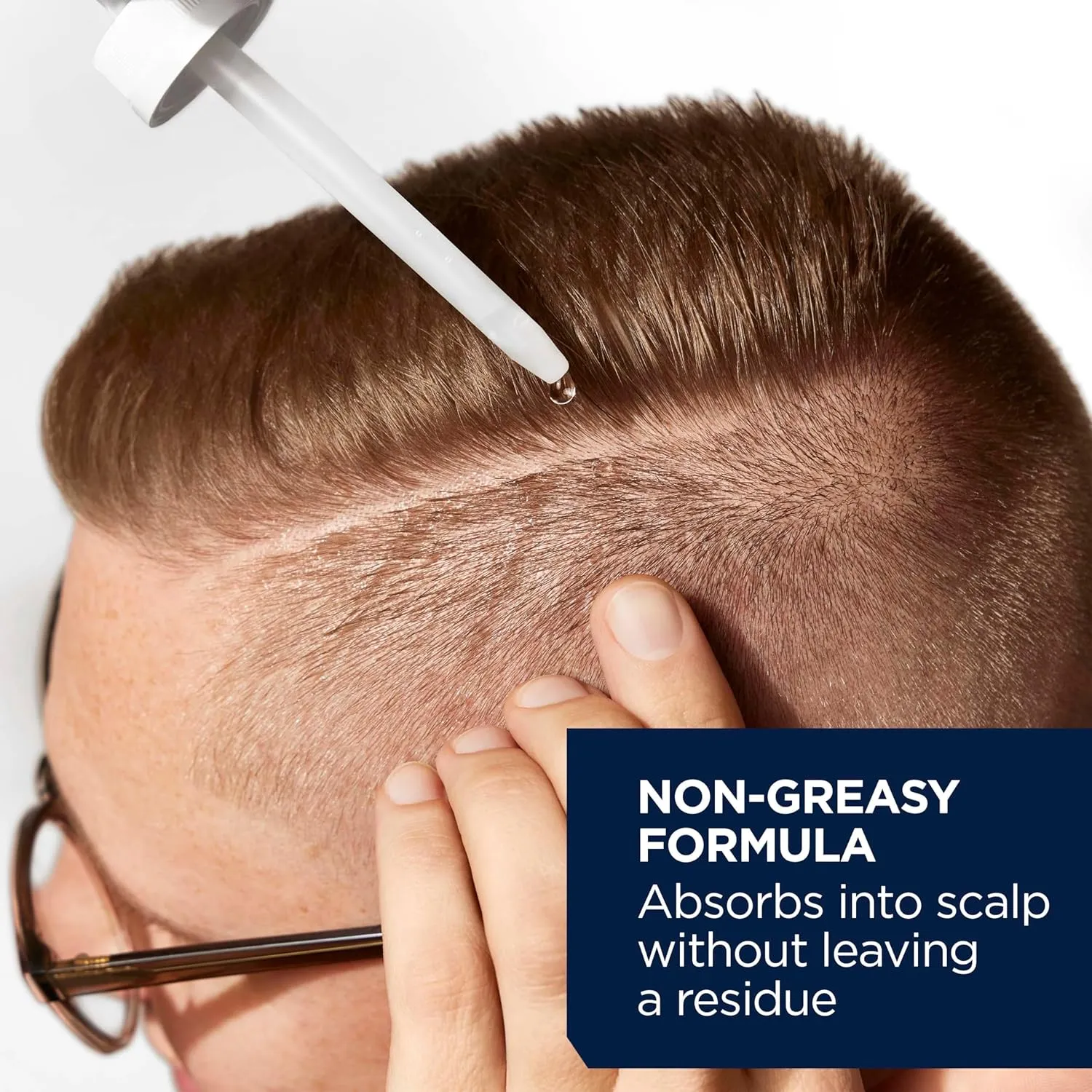 Head & Shoulders Scalp X 5% Minoxidil Hair Regrowth 2x Daily Leave-On Treatment for Men's Thinning Hair & Hair Loss, 3-Month Supply, 2 Fl Oz Each, (Set of 3)