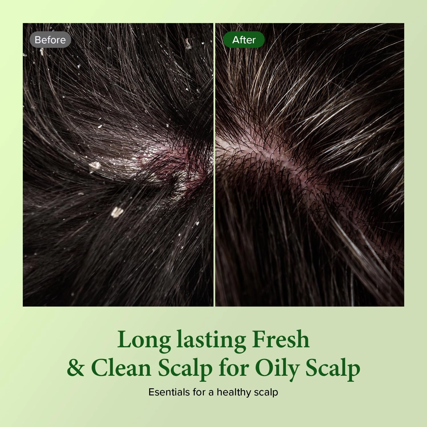 KUNDAL Tea Tree & Macadamia Deep Cleansing Shampoo - Korean Hair Care, Scalp Care, Tea Tree extract, For All hair Types 10.14fl oz each (Pack of 2) (Baby Powder)