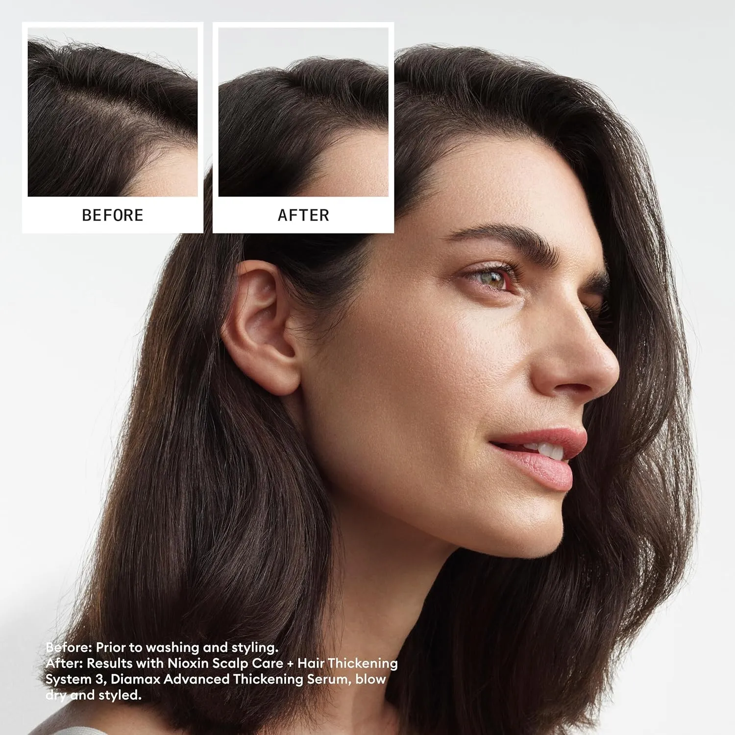 Nioxin System 3 Scalp   Hair Thickening Shampoo for Colored, Dry, & Damaged Hair with Light Thinning |Maintain Vibrant Color |Cleanse, Strengthen & Nourish with Niacinamide & Biotin |Cleanse Build-Up