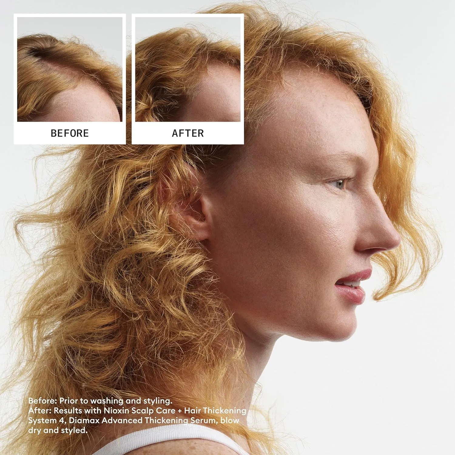 Nioxin System 4 Scalp   Hair Thickening Shampoo For Colored, Dry, & Damaged Hair with Progressed Thinning Maintain Vibrant Color Nourish & Boost Hair Density with Niacinamide & Biotin