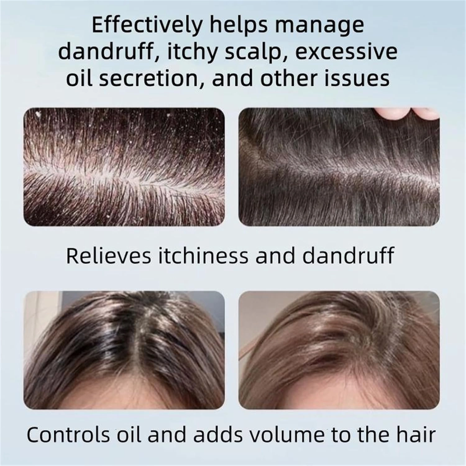 Nipori Shampoo, Nippori Hair Care Shampoo, Oil Control Refreshing Anti-Dandruff for Men & Women, 10.55 Fl.Oz Natural Hair Shampoo (1pc-10.55 fl.oz)