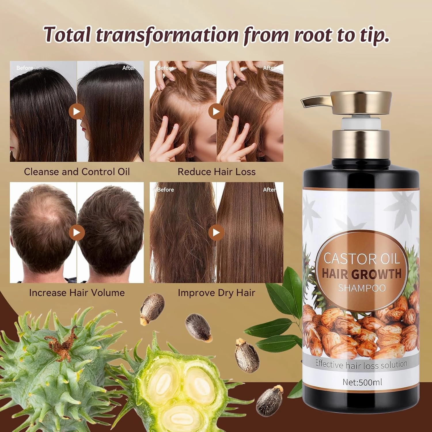 Silvercell Castor Oil for Hair Growth Shampoo, Prevents Hair Loss Shampoo Strengthens Hair Roots, Hair Care Shampoo Nourishes Dry Hair, Hair Thickening Shampoo for Women & Men,16.91 fl.oz, Beige