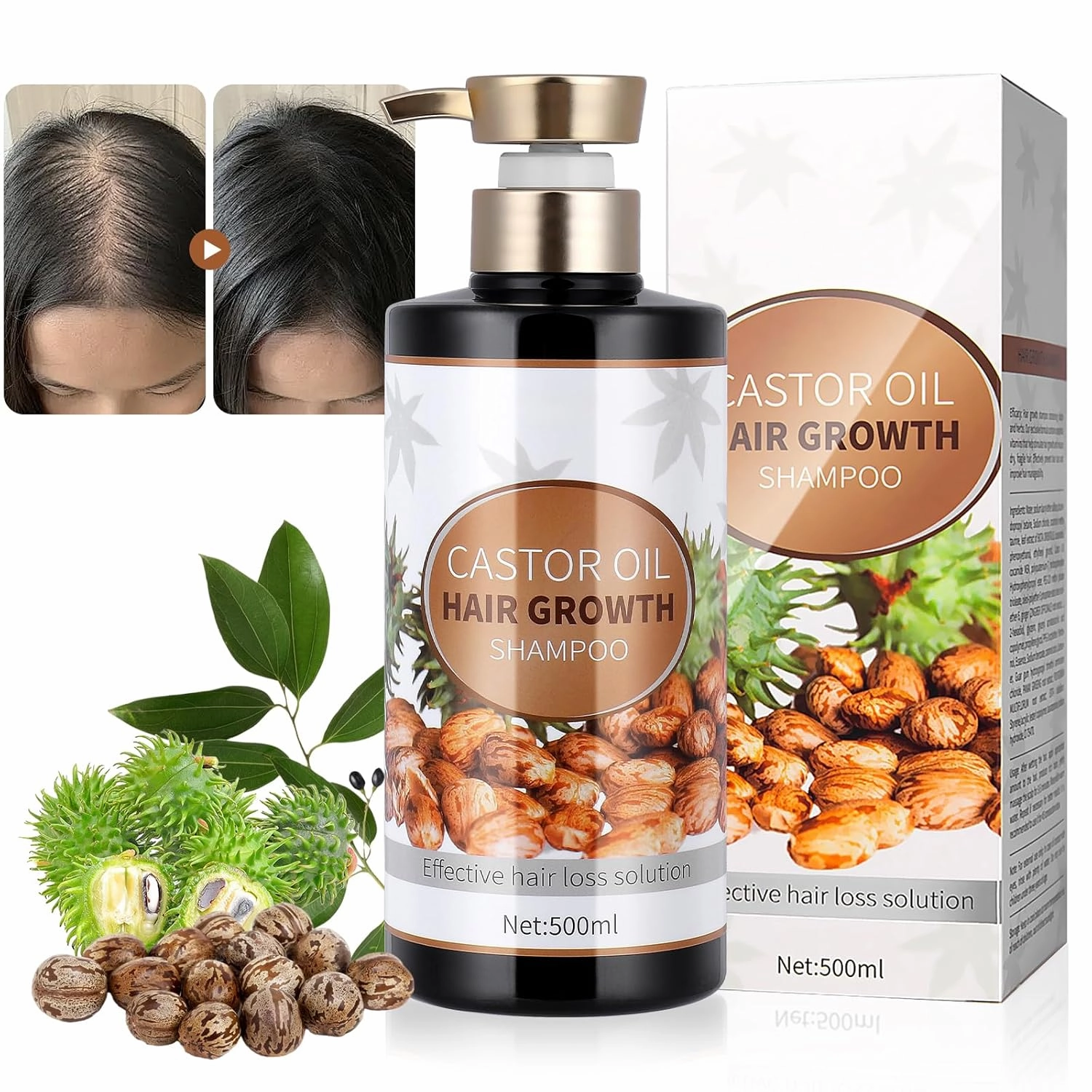Silvercell Castor Oil for Hair Growth Shampoo, Prevents Hair Loss Shampoo Strengthens Hair Roots, Hair Care Shampoo Nourishes Dry Hair, Hair Thickening Shampoo for Women & Men,16.91 fl.oz, Beige