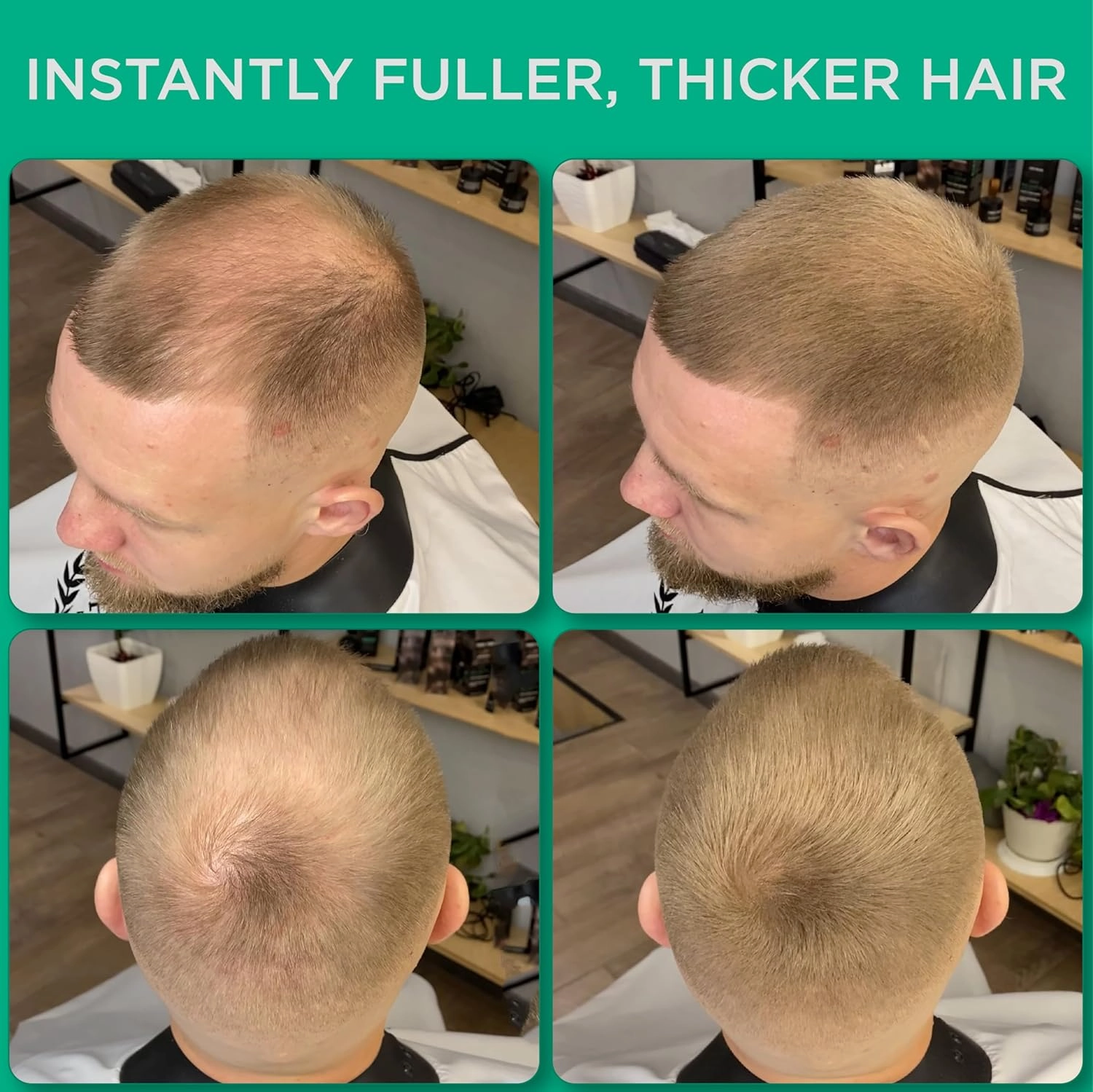 THICK FIBER Hair Fibers for Thinning Hair & Bald spots (LIGHT BROWN, Pack of 2) - 25g Bottle - Conceals Hair Loss in Seconds - Hair Powder For Women & Men