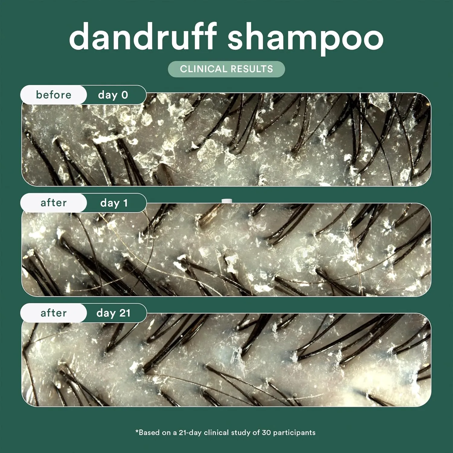 VERB® Dandruff Shampoo - for Gentle Cleansing and Clinical Strength Dandruff Relief with 3% Salicylic Acid